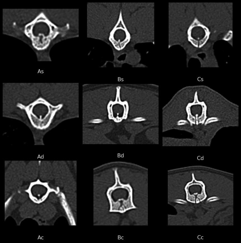 Full source JPEG: CT bone-window figure