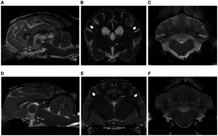 Full source JPEG: MRI brain T2 figure